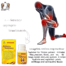 arthro1-min ARTHRO SUPREVIVER